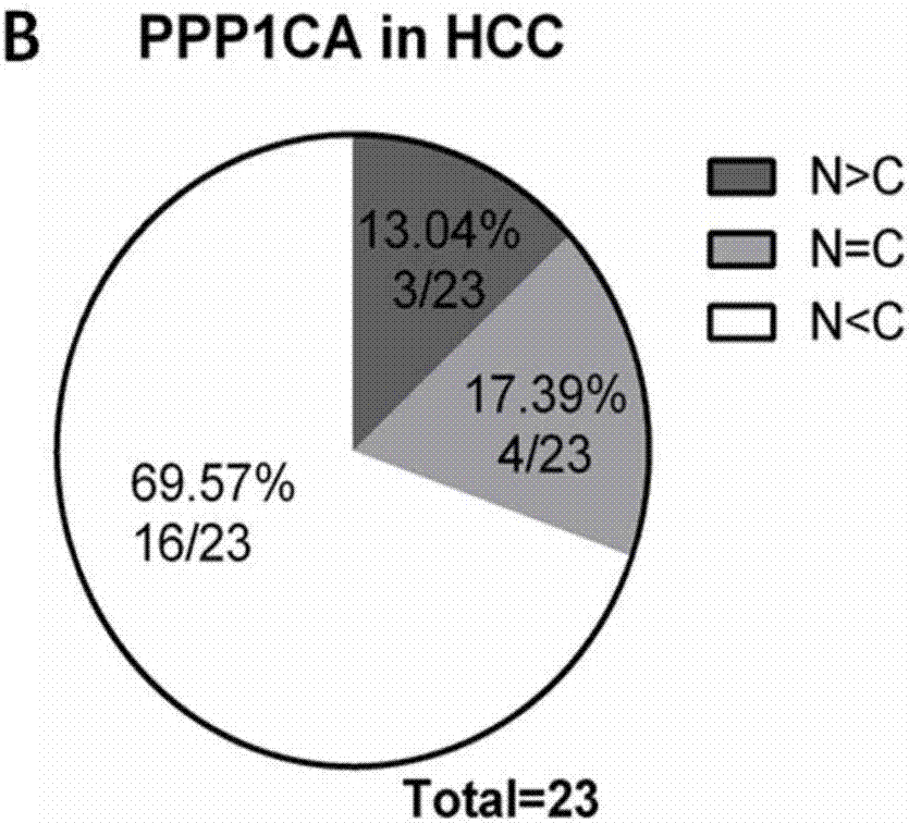 Marker of PPP1CA for liver cancer diagnosis as well as prognosis detection and application thereof