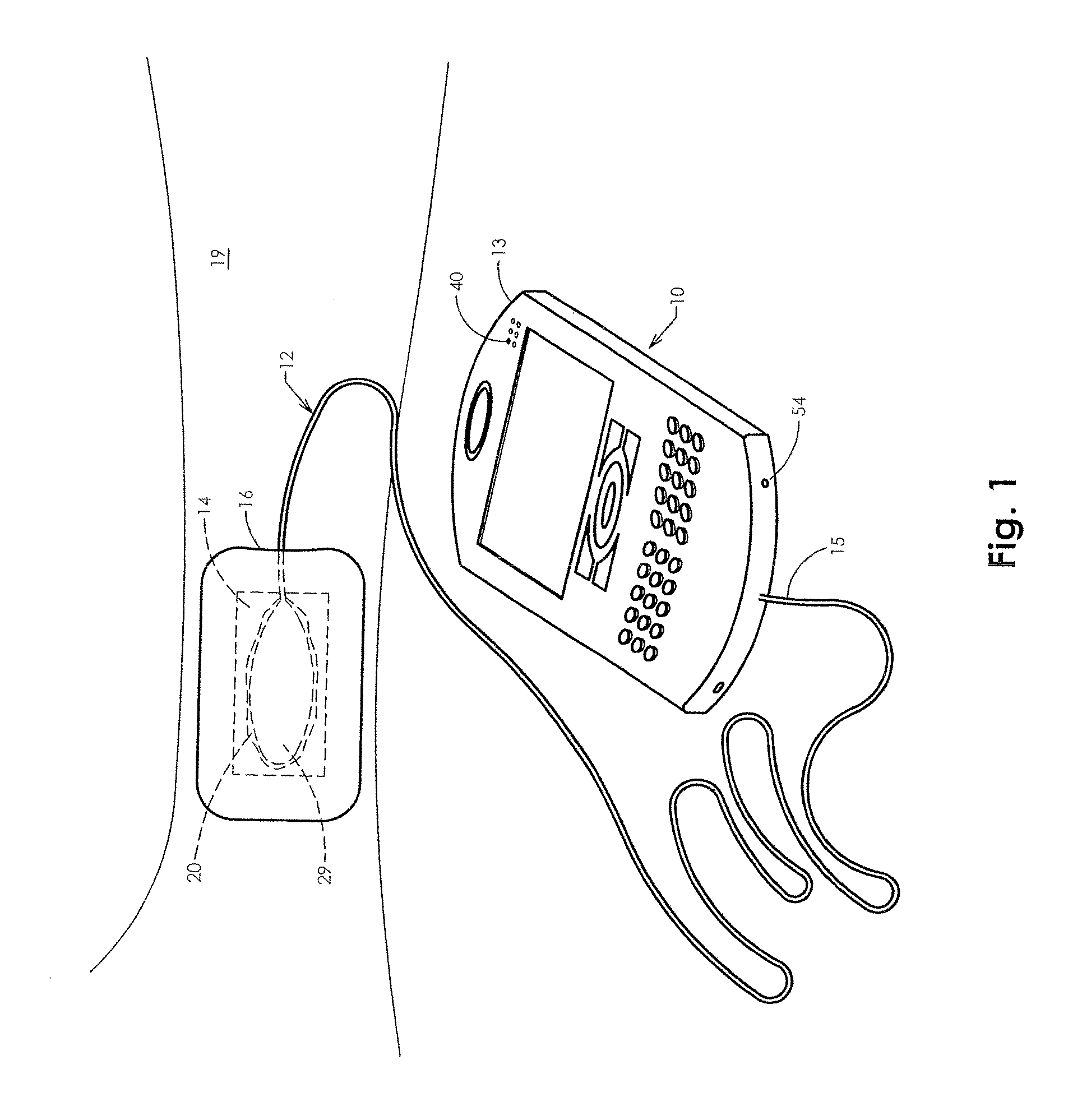 Apparatus and Methods for Controlling Tissue Oxygenation for Wound Healing and Promoting Tissue Viability