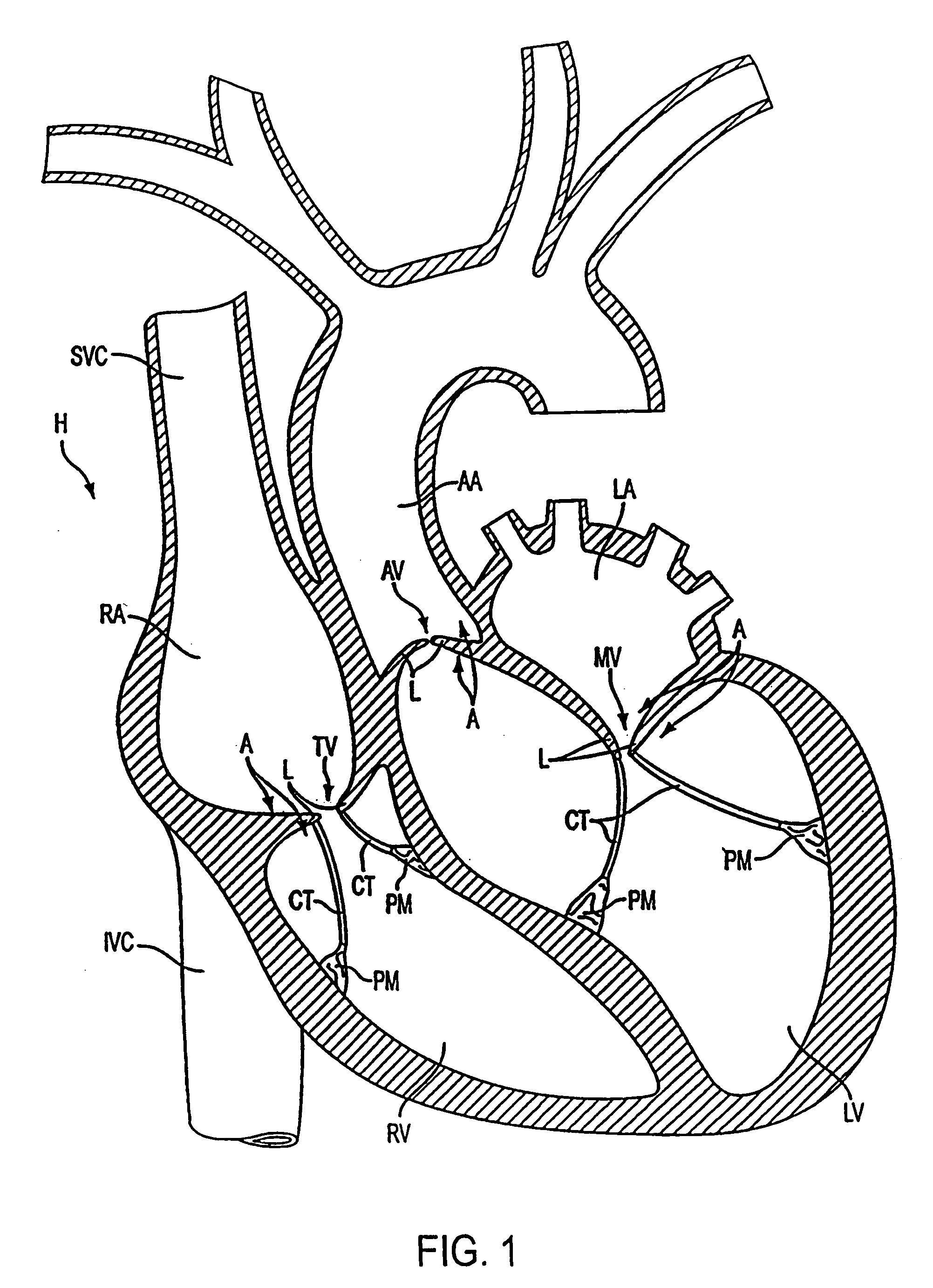 Apparatus and methods for treating tissue