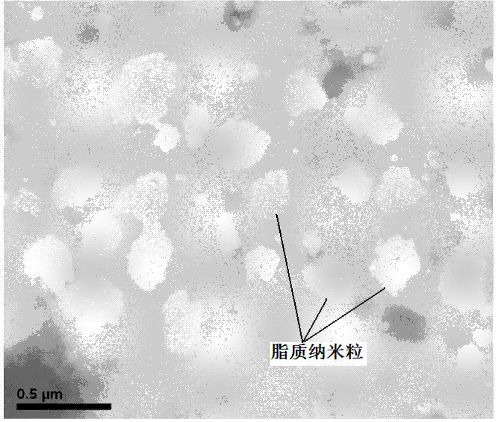 Asiatic acid lipid nanoparticle capable of stimulating oral absorption and preparation method thereof