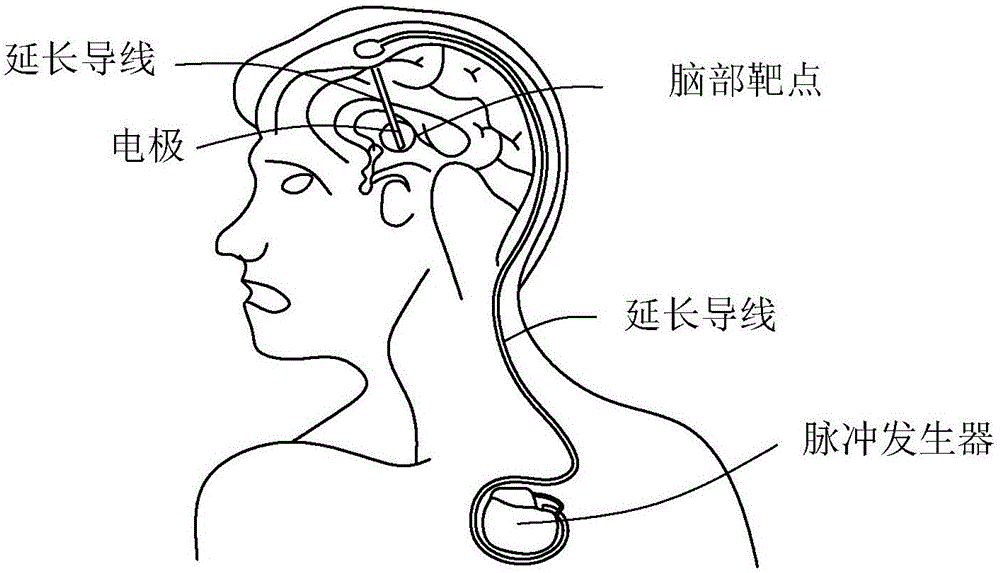 Electric quantity monitoring method and electric quantity monitoring system for deep brain stimulation