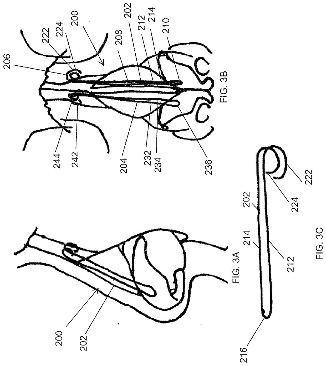 Systems and methods for nasal support