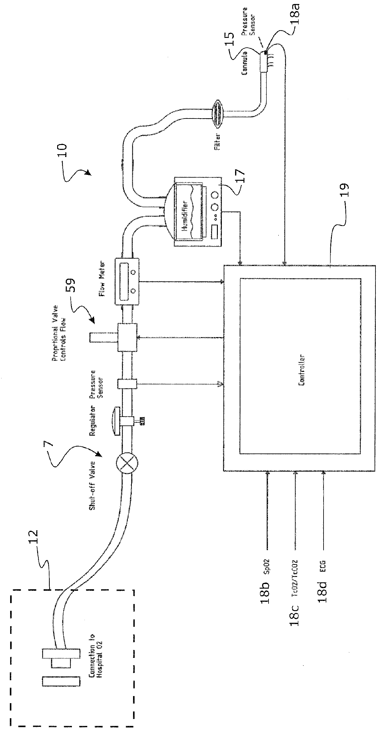 Methods and apparatus for oxygenation and/or co2 removal