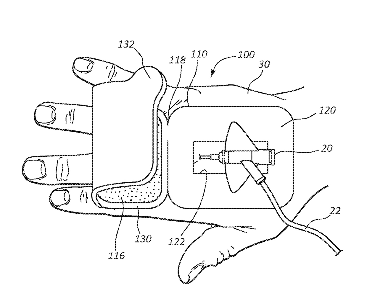 Foldable iv catheter securement dressing for protecting against inadvertent contamination