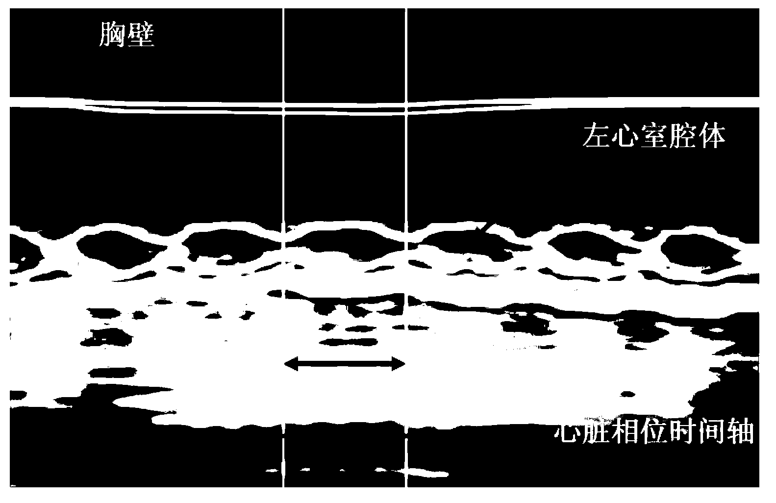 Data processing method and system for cardiac magnetic resonance real-time film imaging