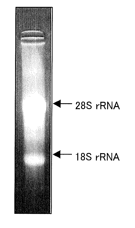 Novel protein capable of binding to hyaluronic acid, and method for measurement of hyaluronic acid using the same