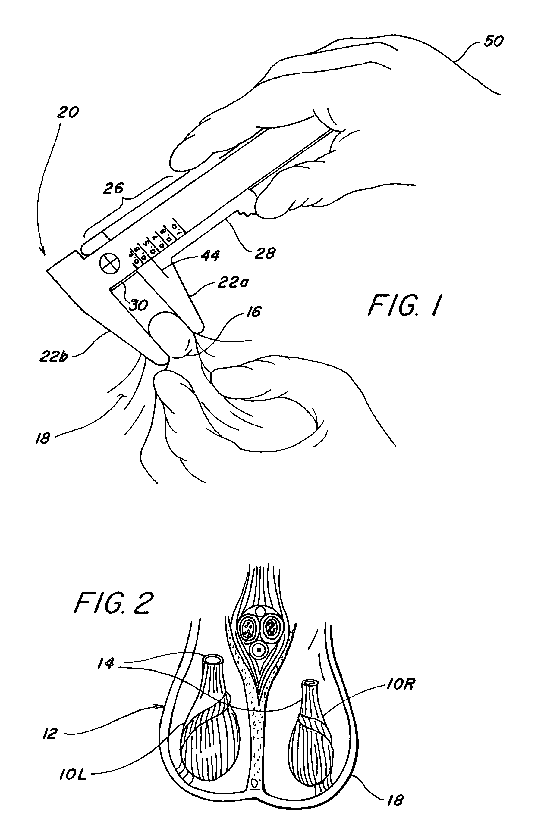 Instrument for determining intratesticular dose and method for determining a dose
