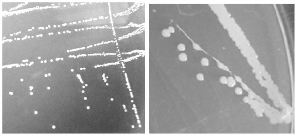 A salt-alkali-resistant and disease-resistant growth-promoting bacterium Microbacterium longus and its application