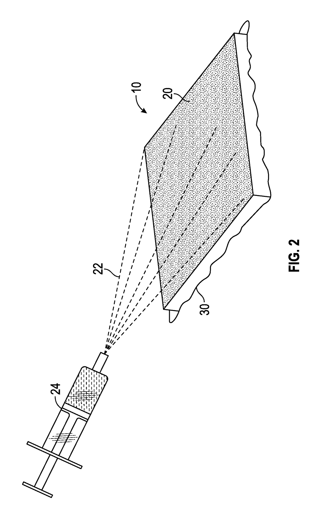 Scaffold-based wound care delivery system and method