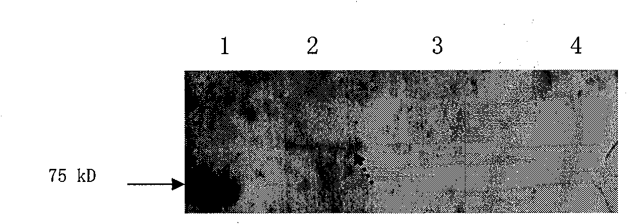 Multi-copy integrated expression vector and preparation method and application thereof in expression of bovine lactoferrin