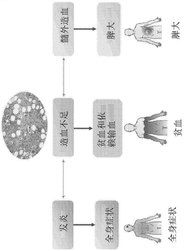 Platelet count-agnostic methods of treating myelofibrosis