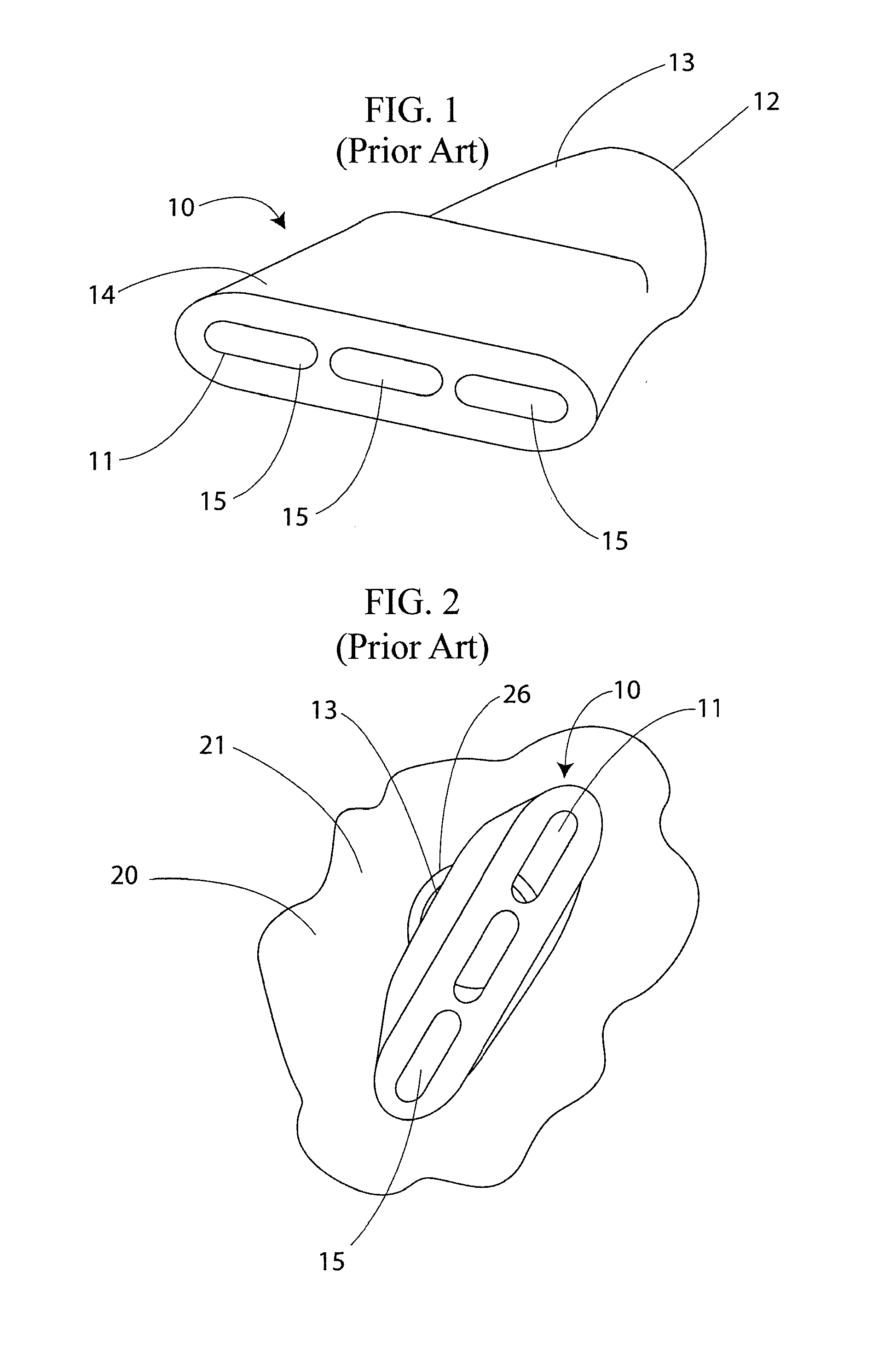 Removable Nozzle for Use With Air Cannons and Aerators and Method for Replacing Same