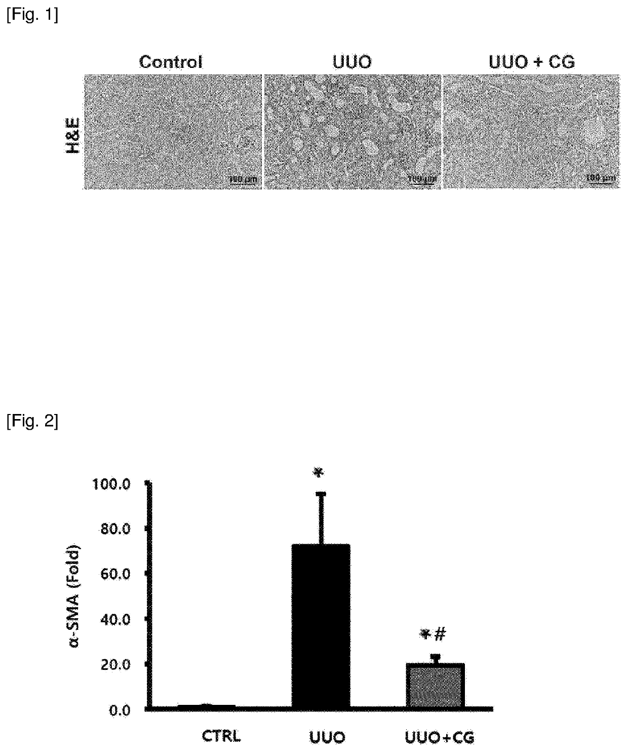 Pharmaceutical composition for prevention or treatment of fibrosis