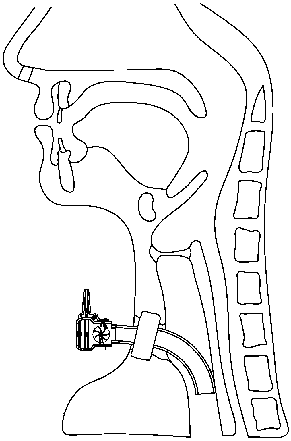 Somatosensory comfortable speech device