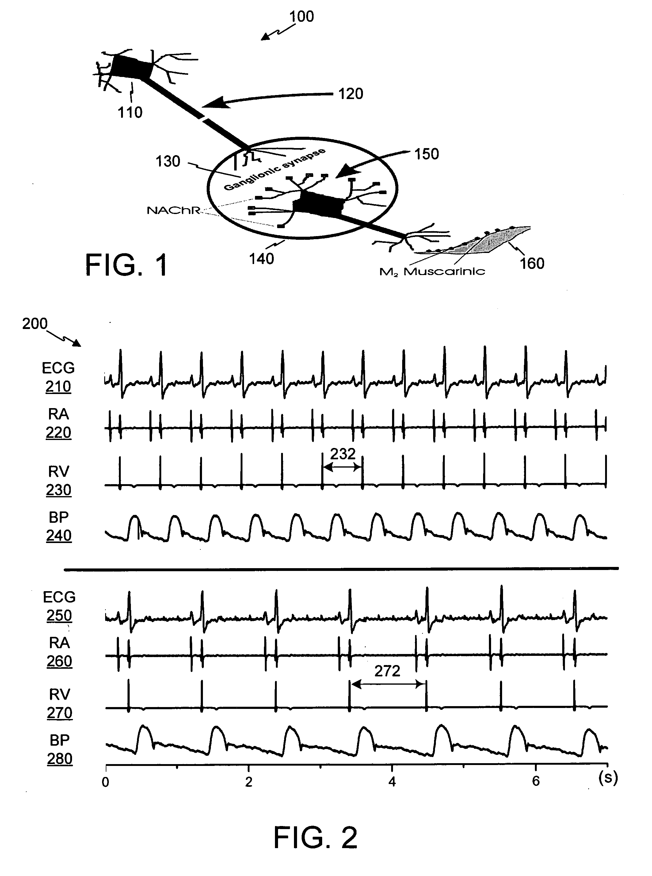 Control of cardiac arrhythmias by modification of neuronal conduction within fat pads of the heart