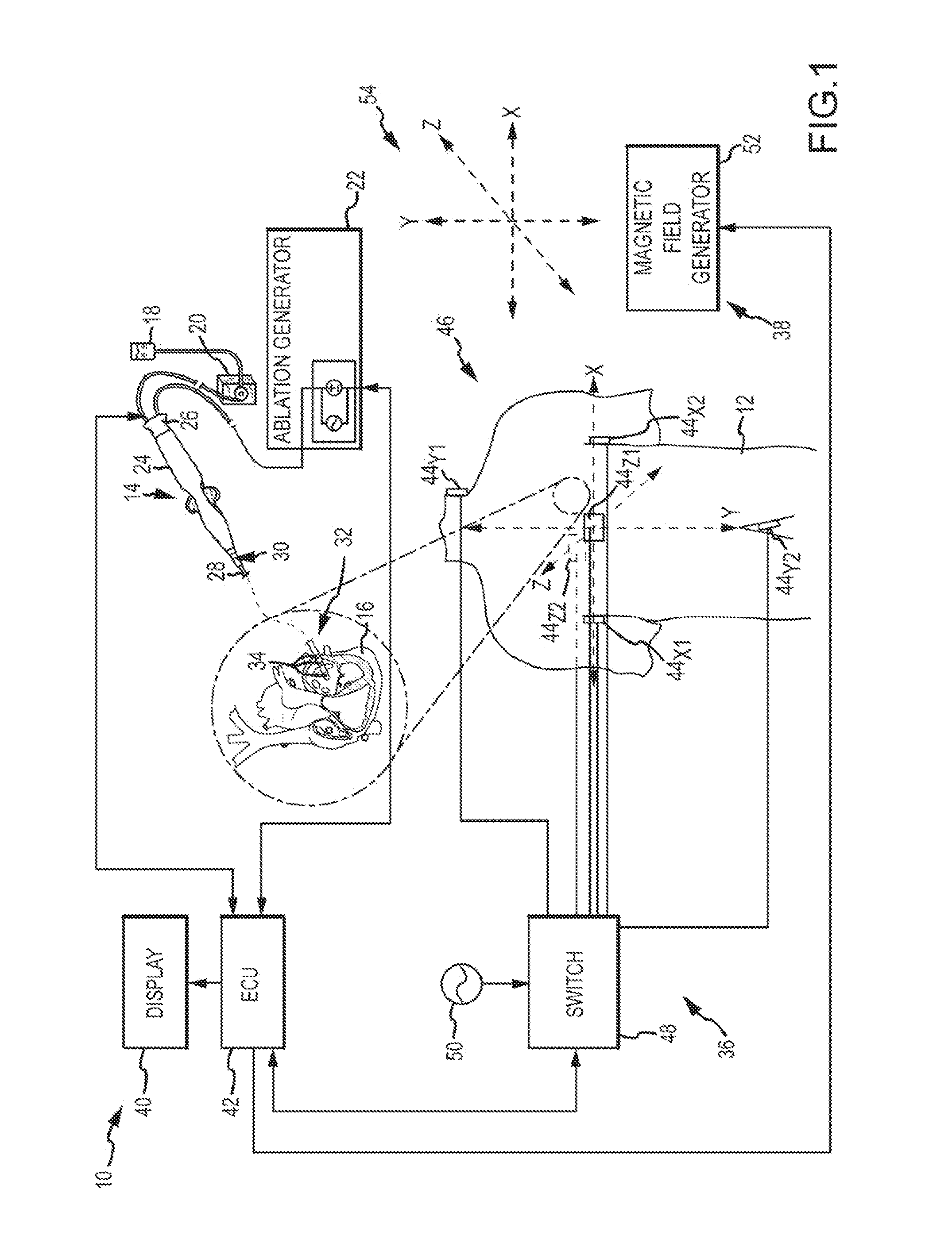 System for detecting catheter electrodes entering into and exiting from an introducer