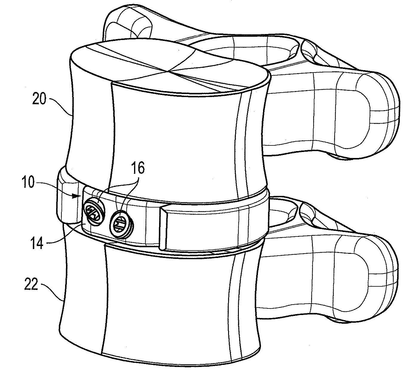 Interbody fusion device with lipped anterior plate and associated methods