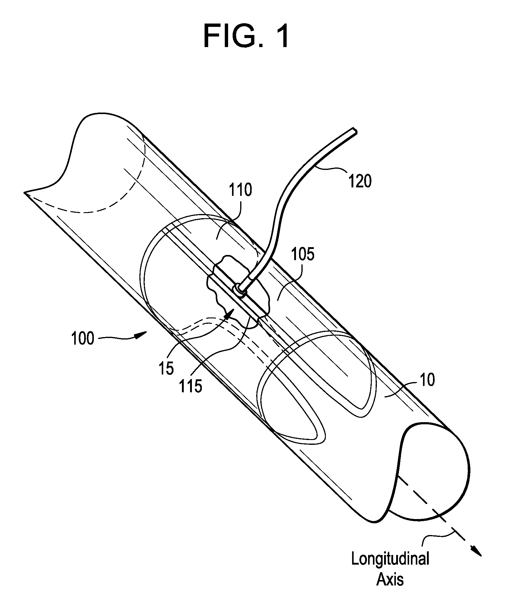 Vasculature Closure Devices and Methods
