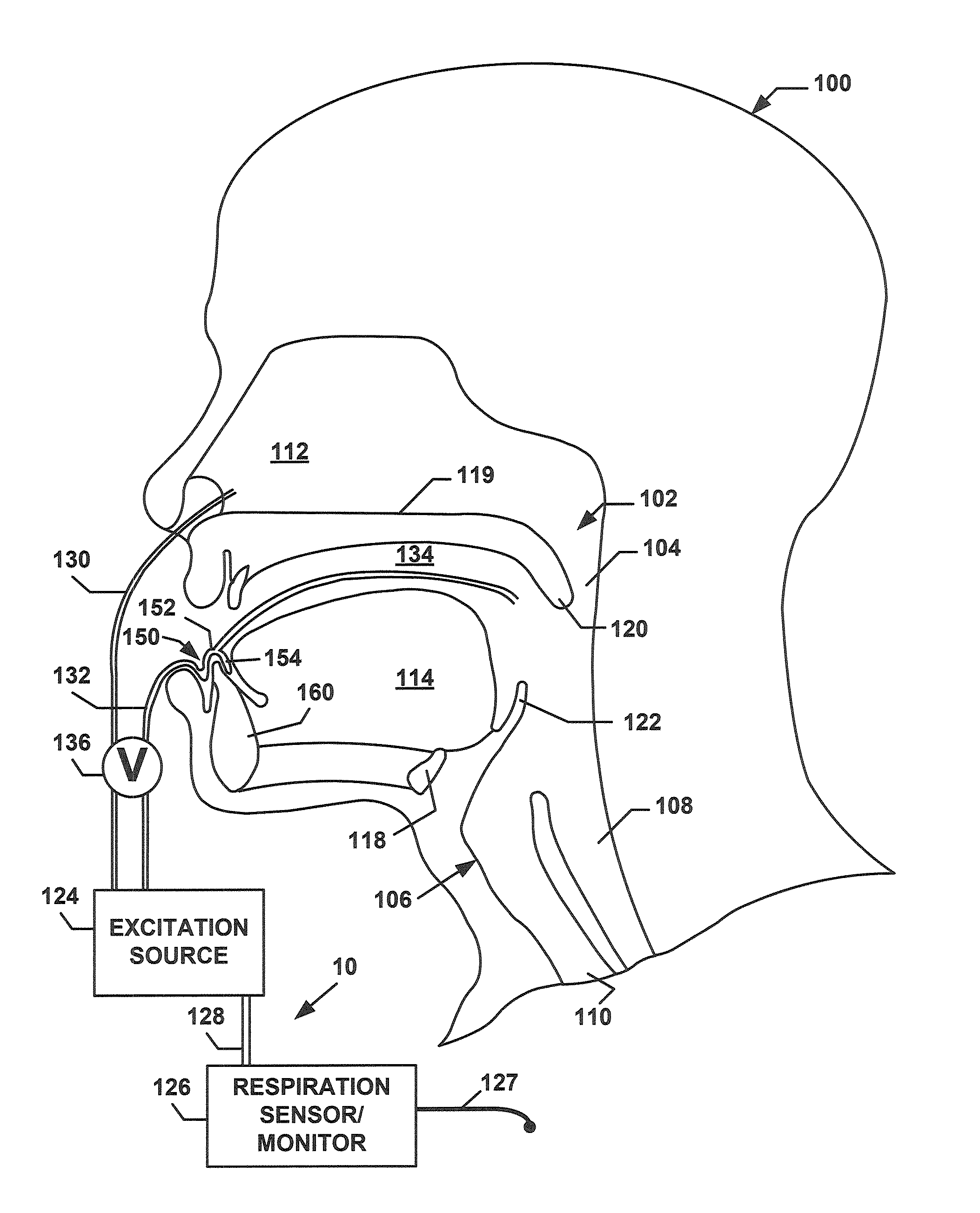 Discontinuous positive airway pressure device and method of reducing sleep disordered breathing events