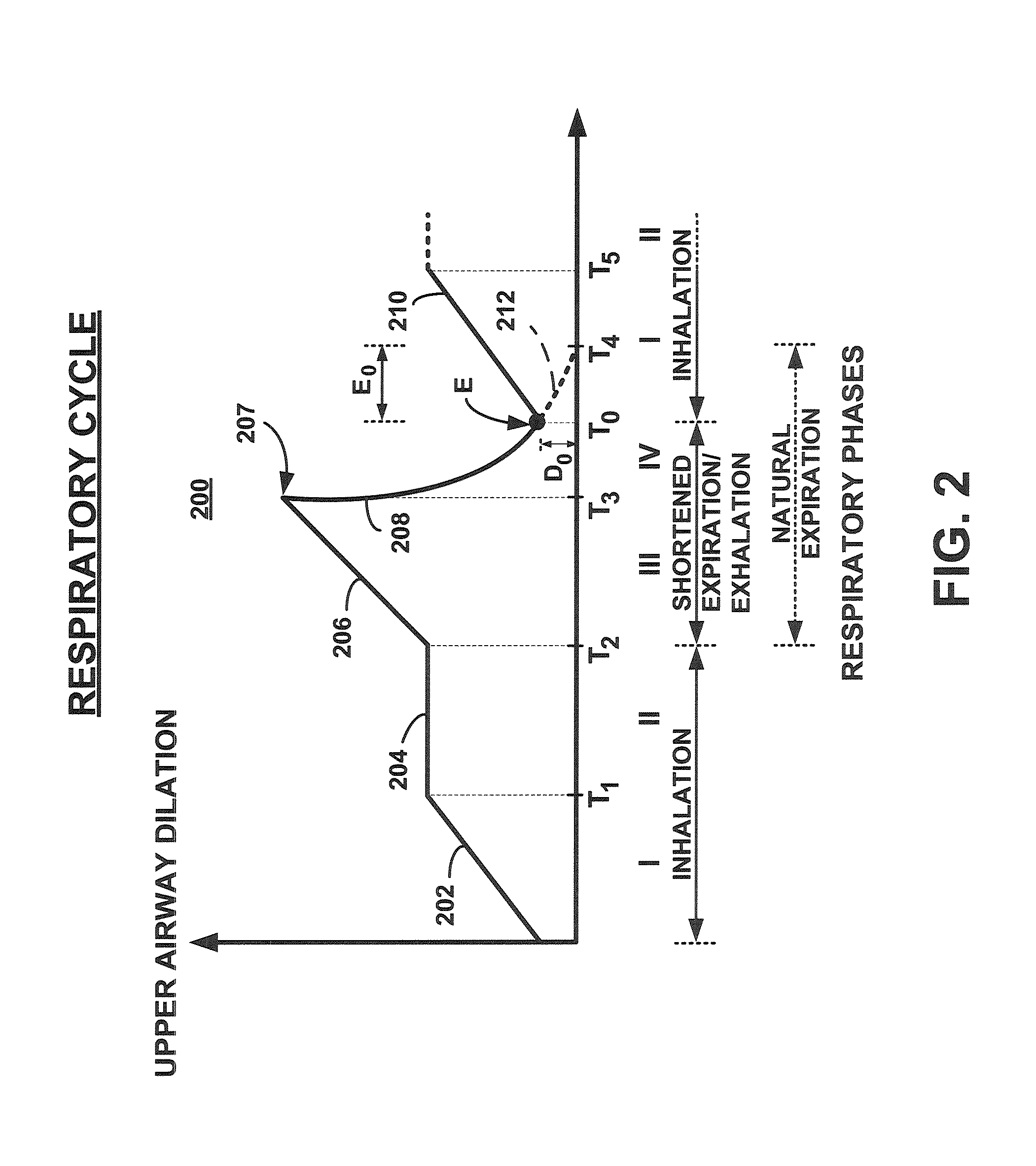 Discontinuous positive airway pressure device and method of reducing sleep disordered breathing events