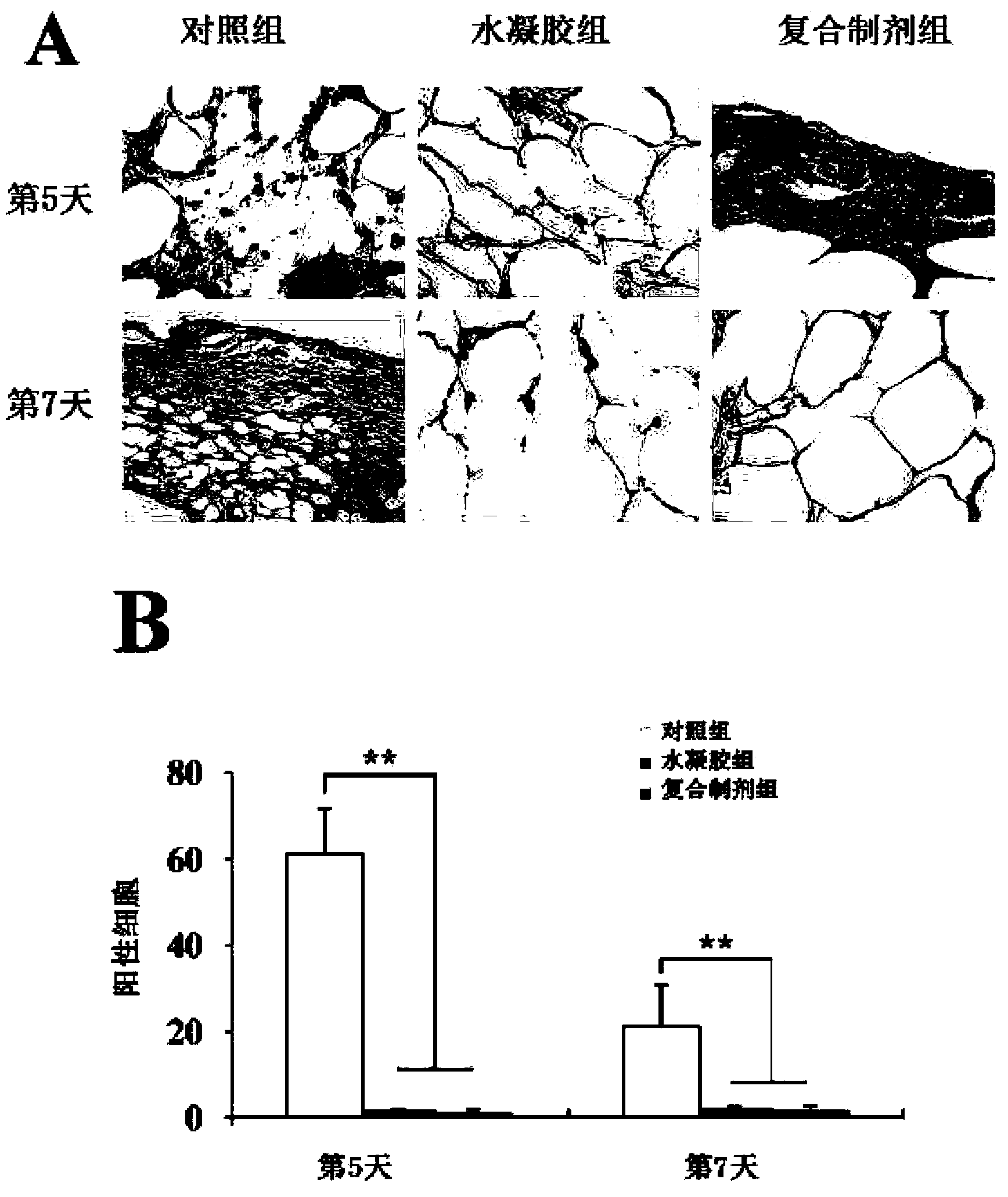 Composite preparation capable of promoting restoration of skin wound due to diabetes and preparation method thereof