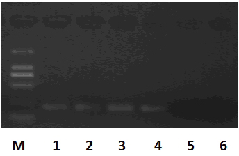 Detection primers for QacC gene in MRSA (methicillin resistant staphylococcus aureus) and detection method thereof