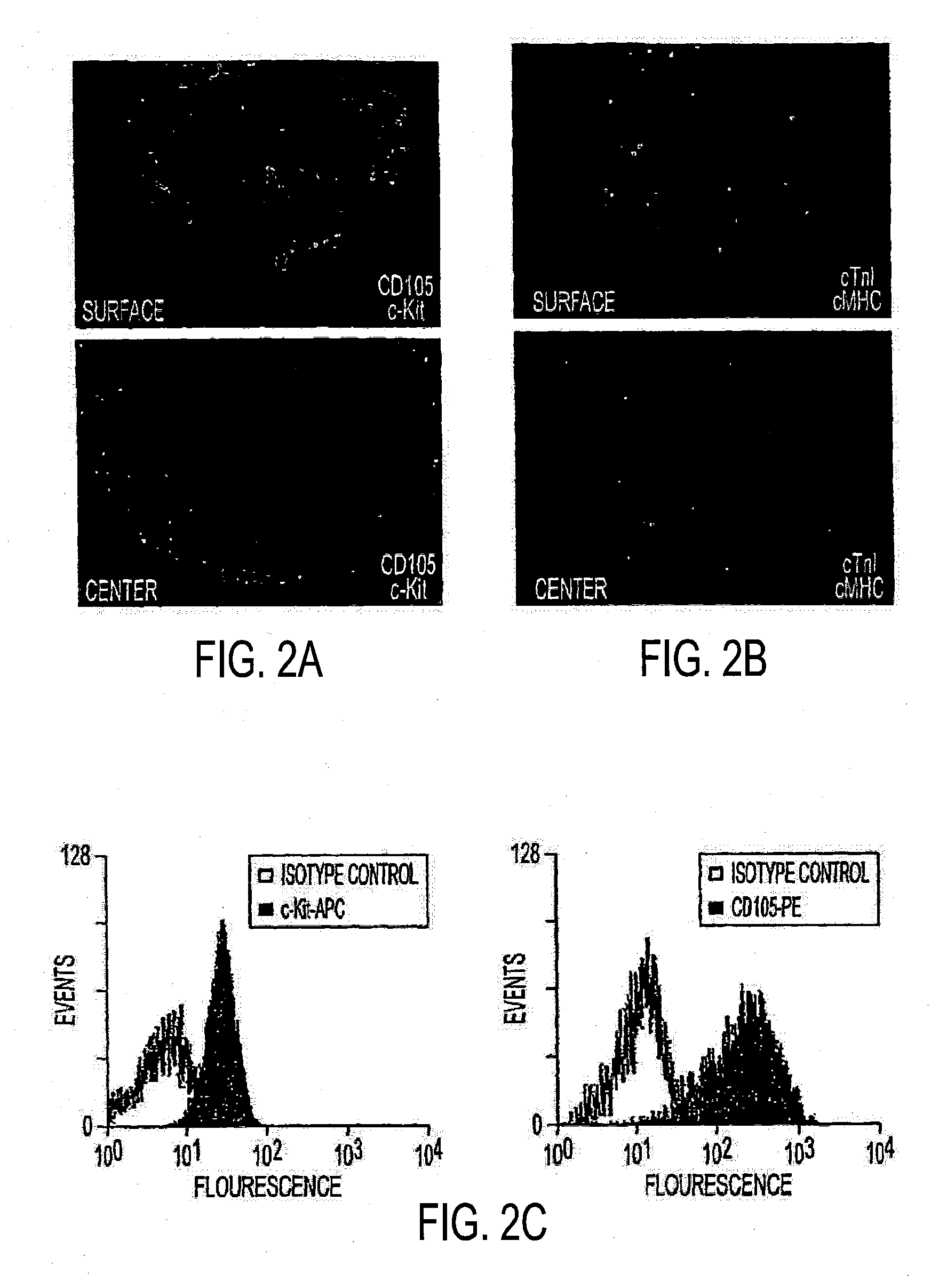 Methods of Reducing Teratoma Formation During Allogeneic Stem Cell Therapy