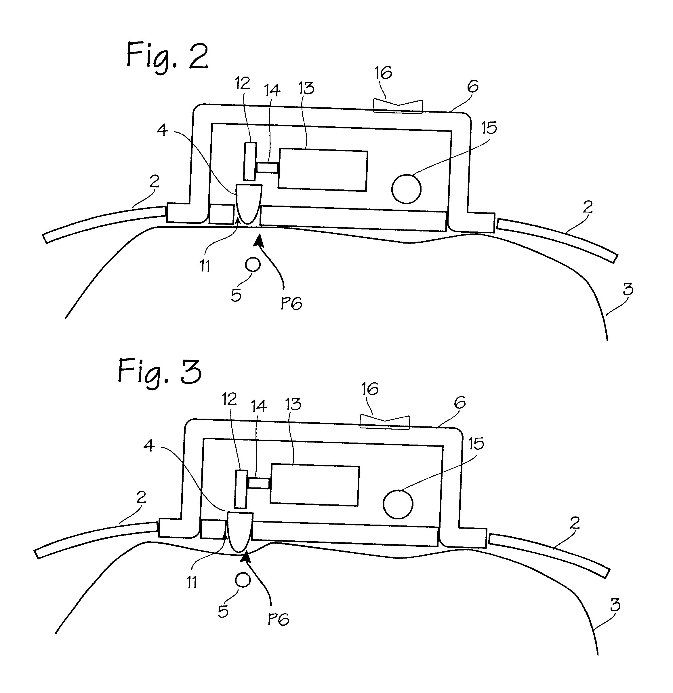 Automatically modulating acupressure device