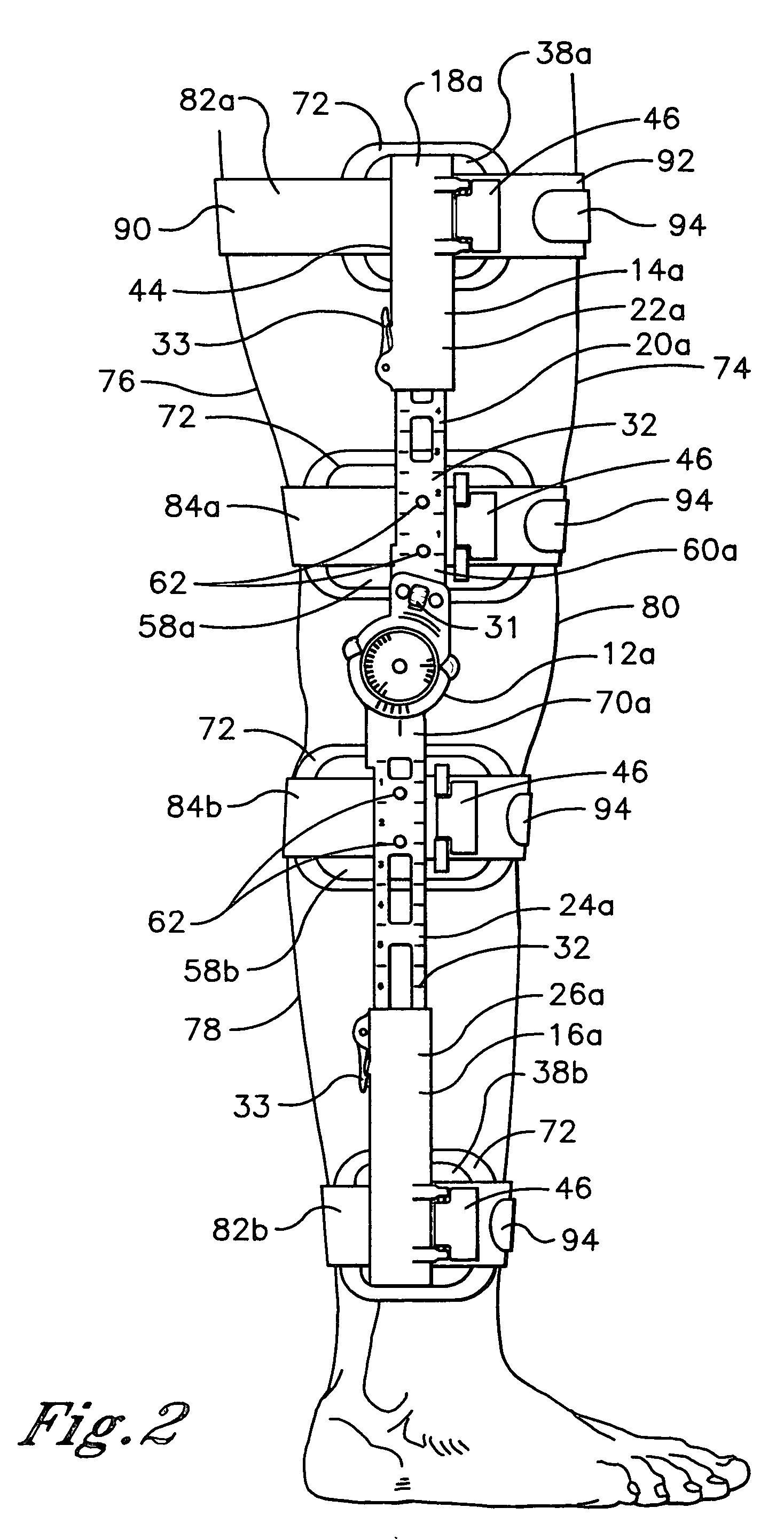 Method for fitting an orthopedic brace to the body
