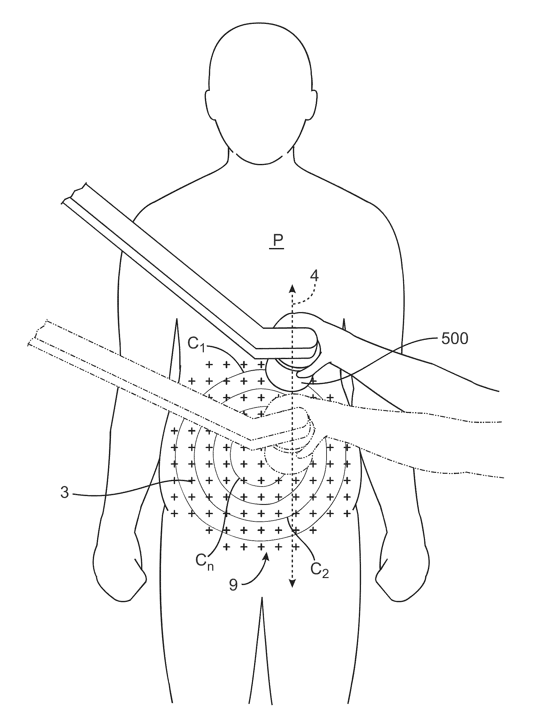 Apparatus and methods for the destruction of adipose tissue