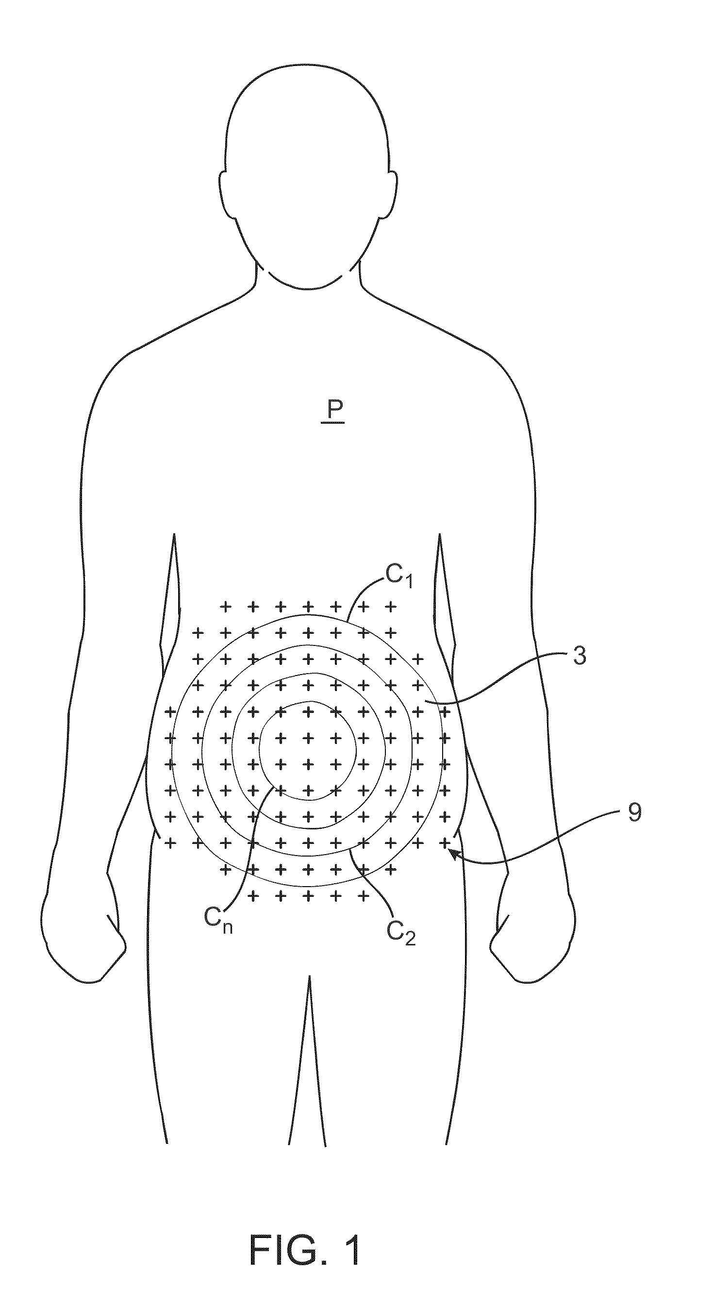 Apparatus and methods for the destruction of adipose tissue