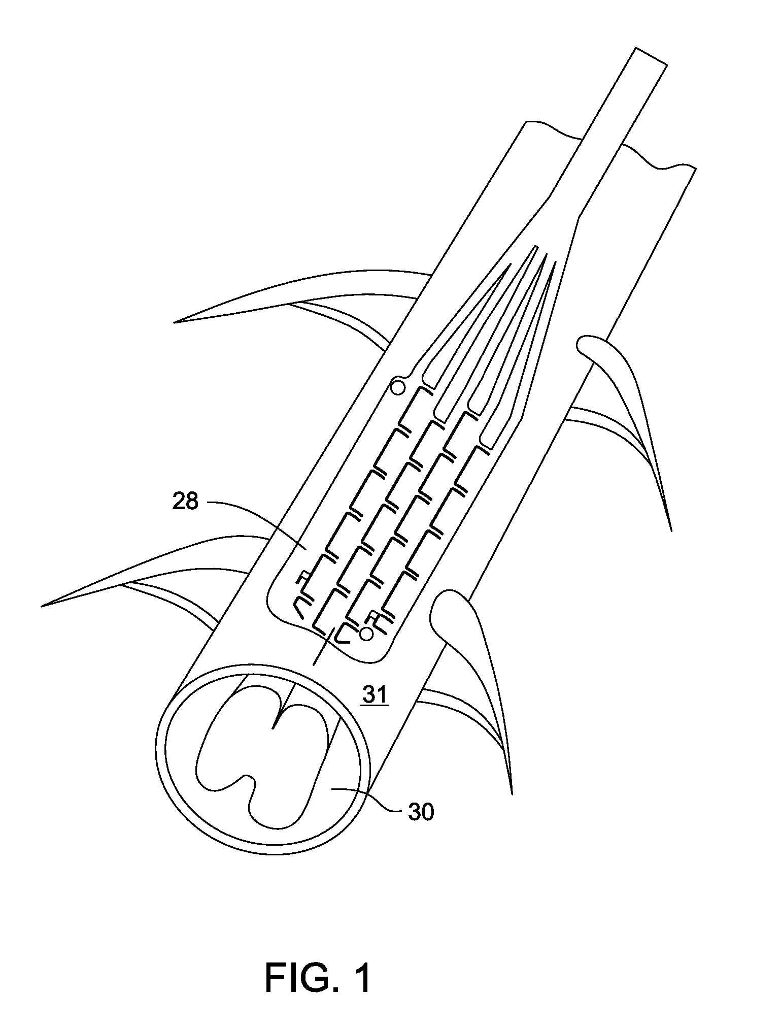 Electrode array and deployment assembly including an electrode array that is folded into a cannula that is narrower in width than the array