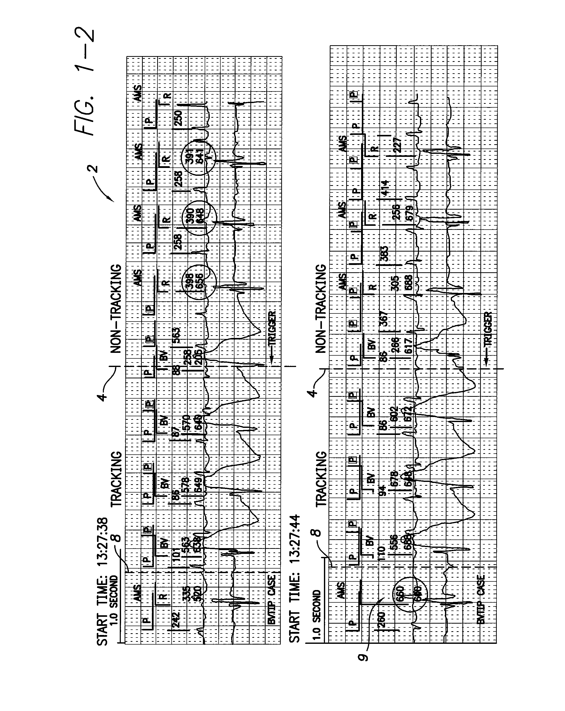 System and method for detecting hidden atrial events for use with automatic mode switching within an implantable medical device