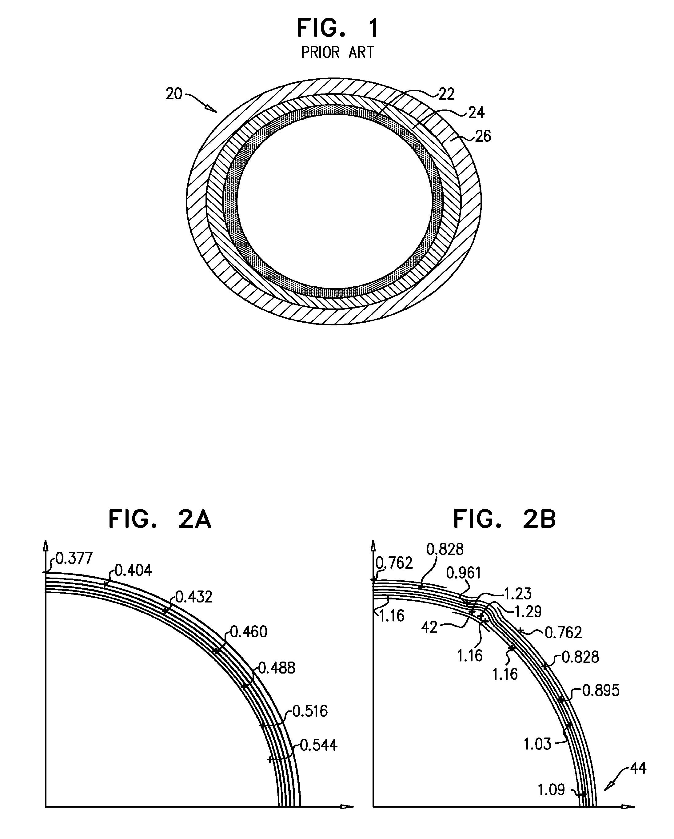 Devices and Methods for Control of Blood Pressure