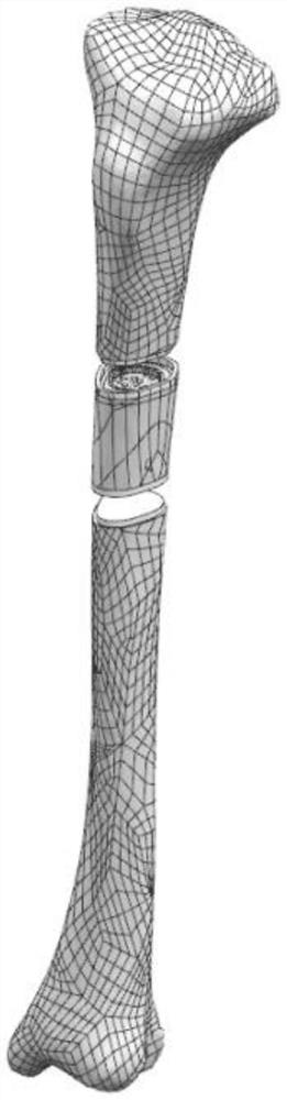 Individual customized bionic transplantation bone block for filling long bone defect