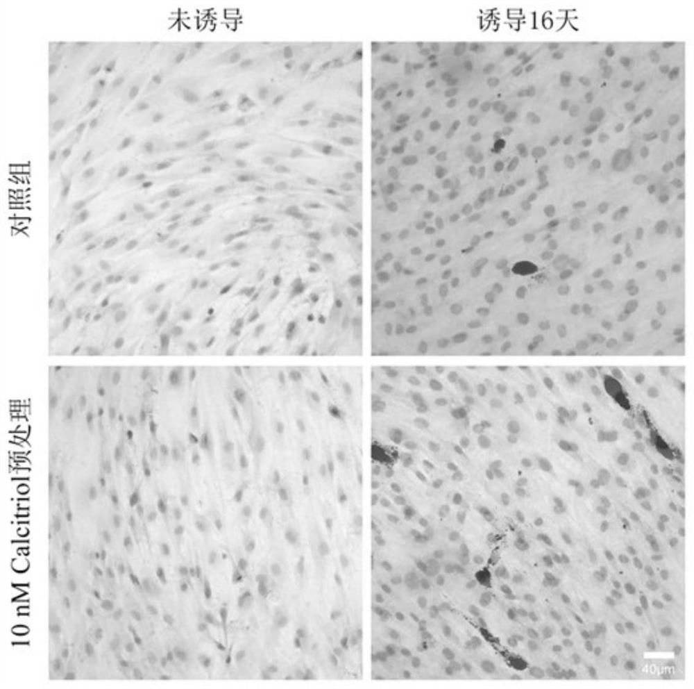 Application of vitamin d3 and its analogs in promoting the differentiation of human skin fibroblasts into adipocytes