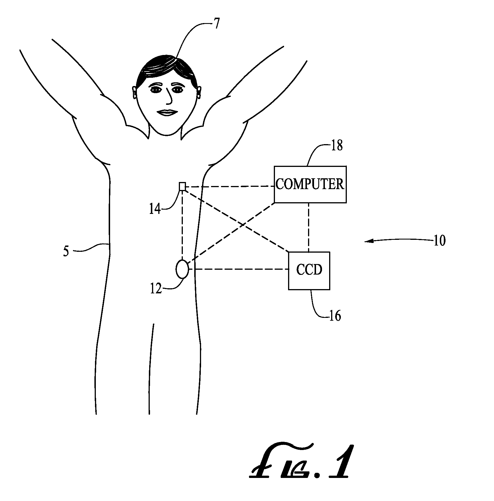 Engagement and sensing systems and methods