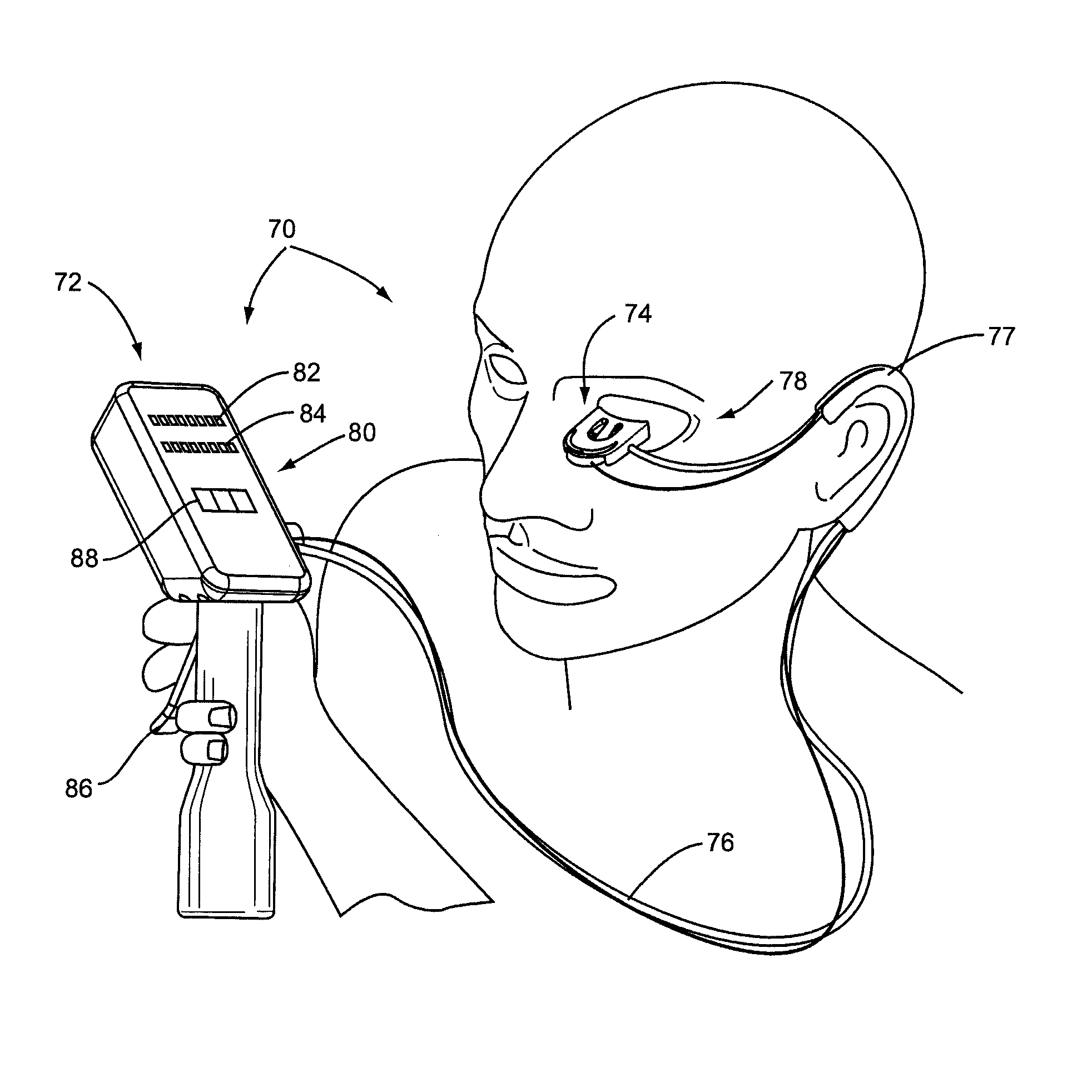 System for inner eyelid treatment of meibomian gland dysfunction