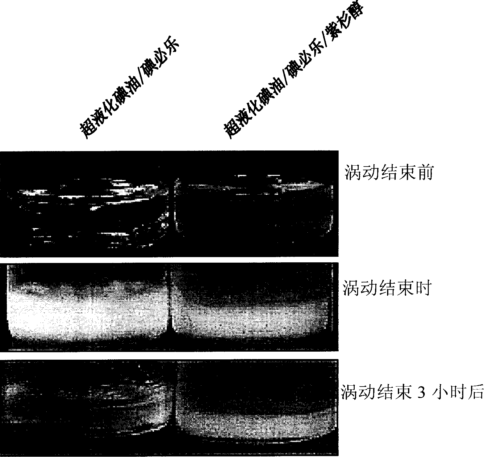 Paclitaxel mixed composition and water-in-oil type emulsion formulation for chemoembolization and preparation method thereof