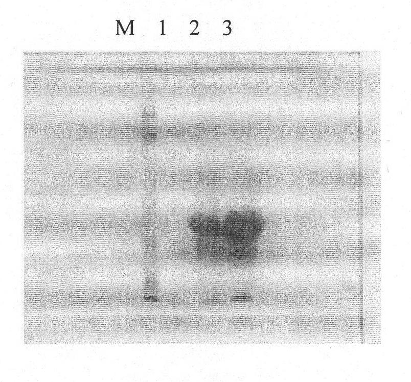 Preparation method of recombinant tumor specificity antiapoptotic factors with activity and application of products thereof