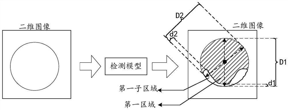 Blood vessel image detection method, detection model training method, related device and equipment