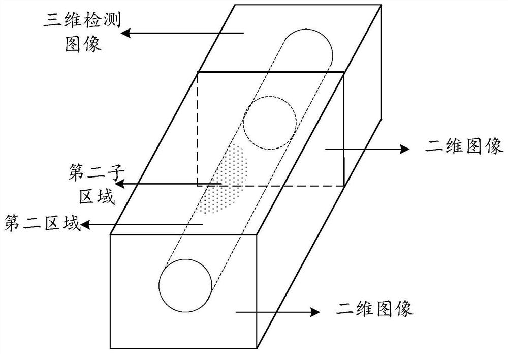 Blood vessel image detection method, detection model training method, related device and equipment