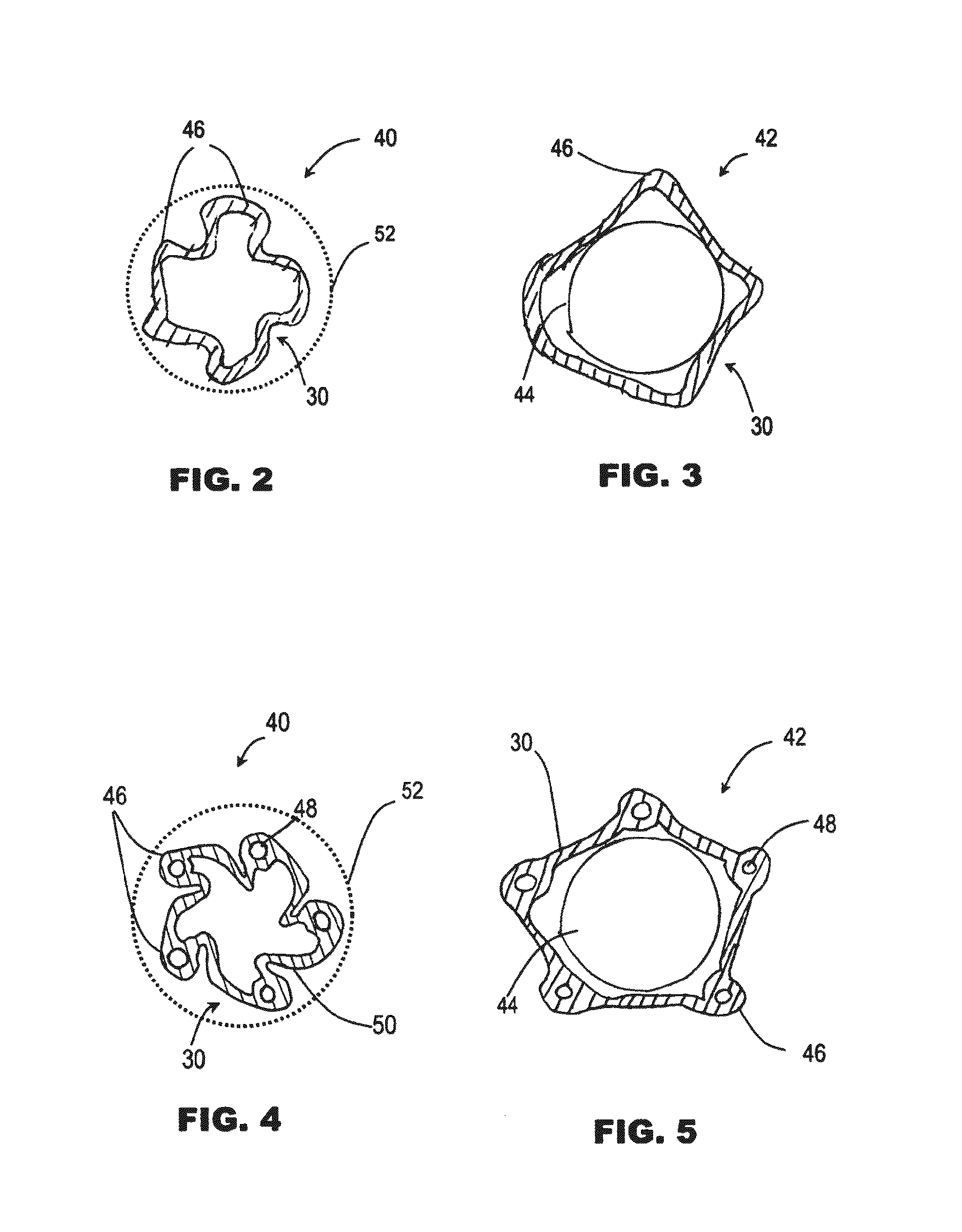 Method and Apparatus Useful for Transcatheter Aortic Valve Implantation