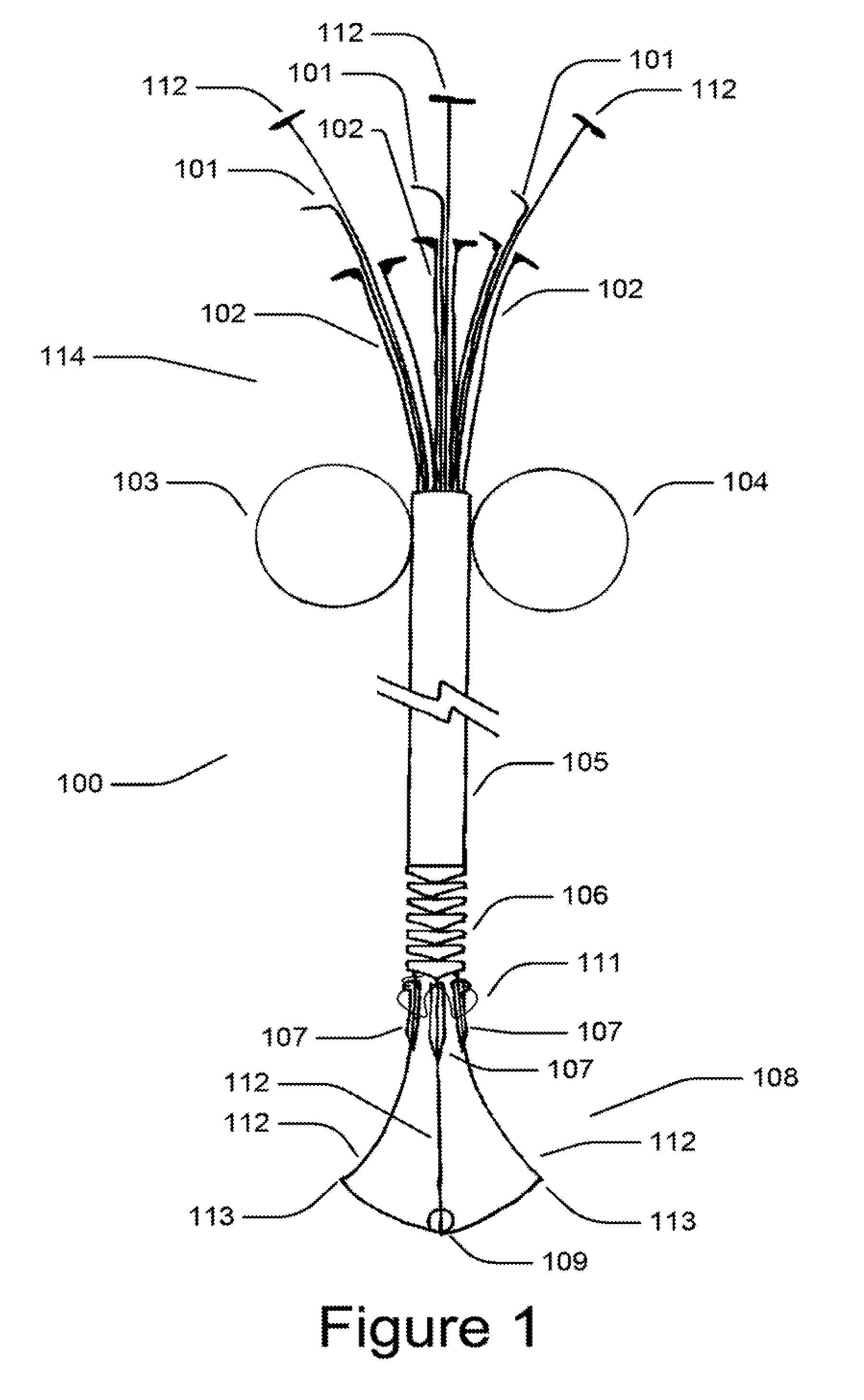 Medical device for constricting tissue or a bodily orifice, for example a mitral valve