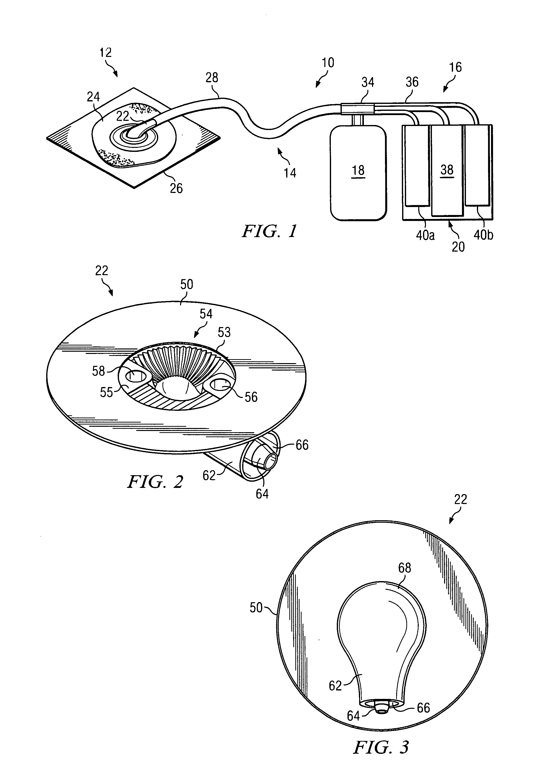 Systems and methods for improved connection to wound dressings in conjunction with reduced pressure wound treatment systems
