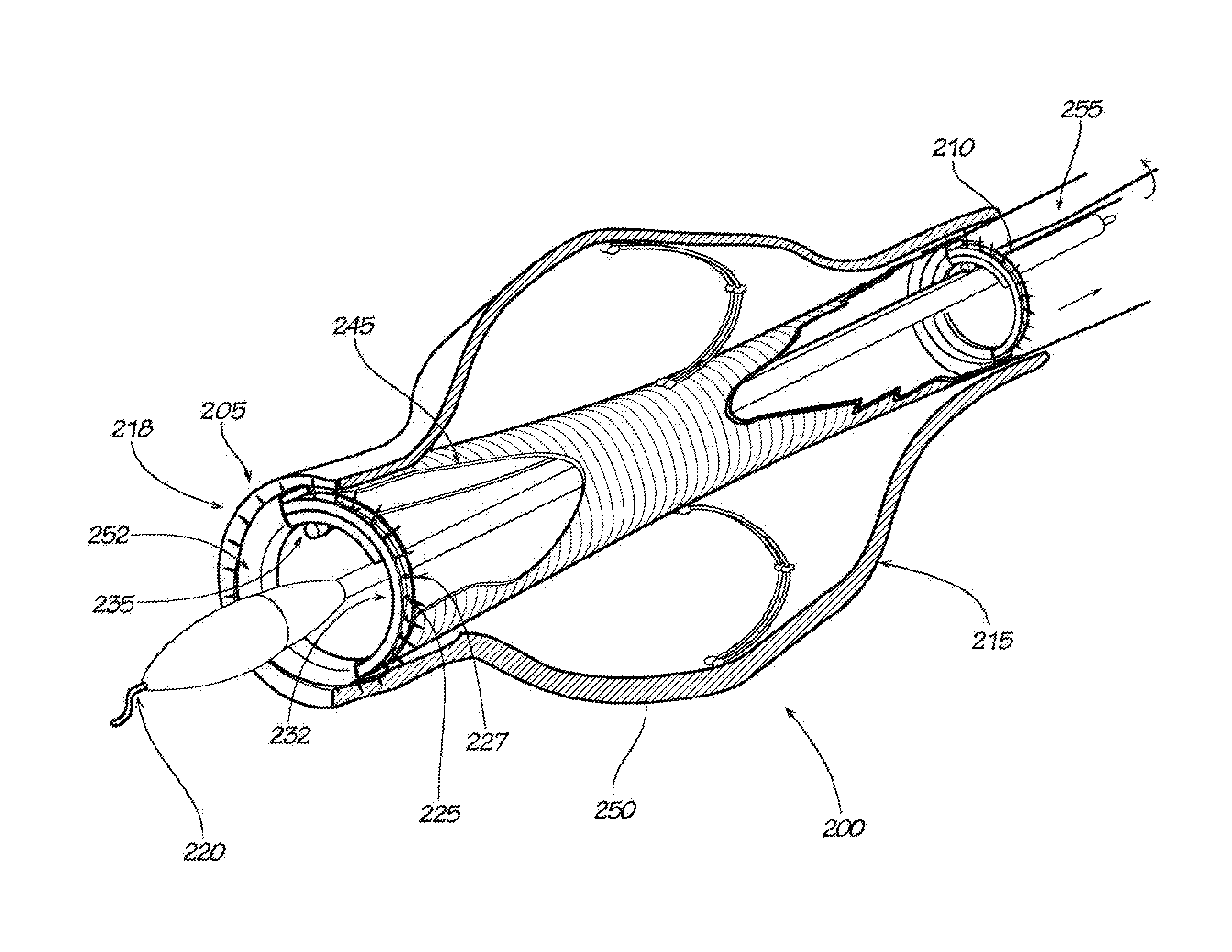 Surgical Implant Devices and Methods for their Manufacture and Use
