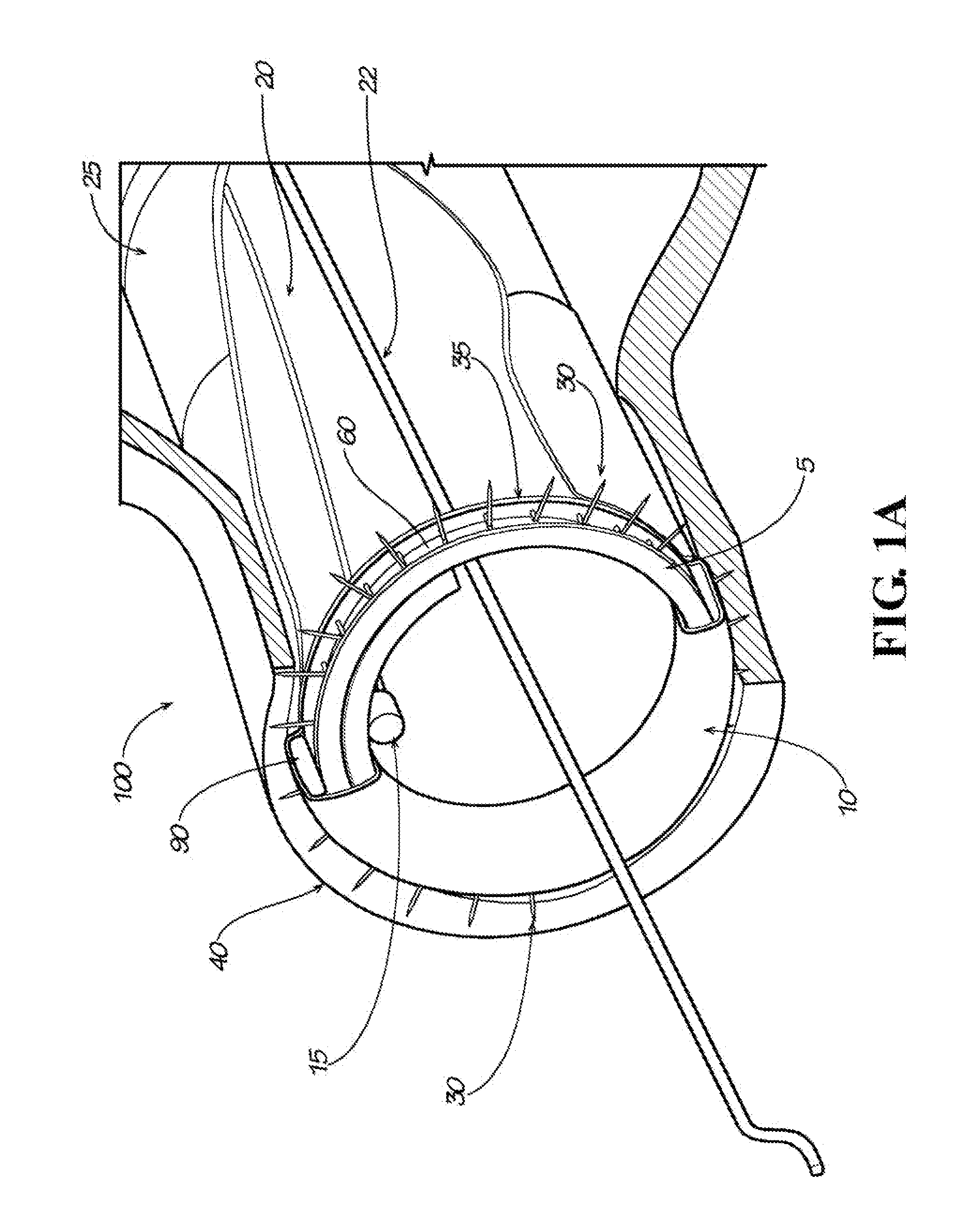 Surgical Implant Devices and Methods for their Manufacture and Use