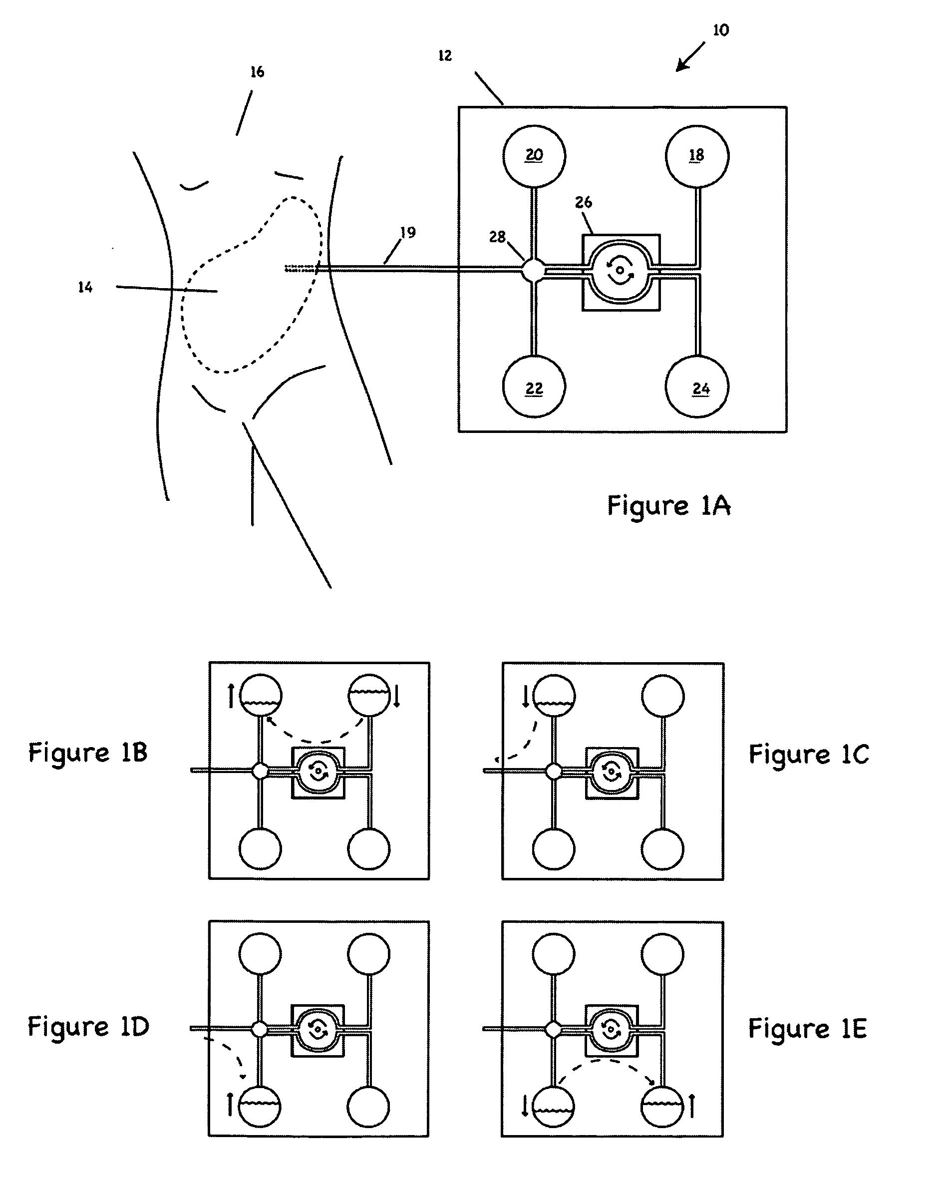 Apparatus and methods for early stage peritonitis detection including self-cleaning effluent chamber
