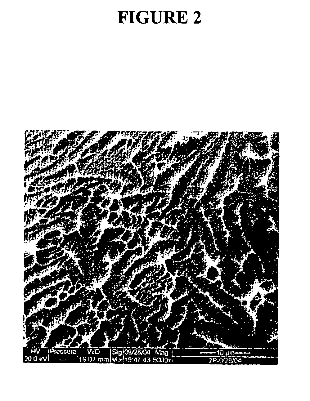 Implants with textured surface and methods for producing the same
