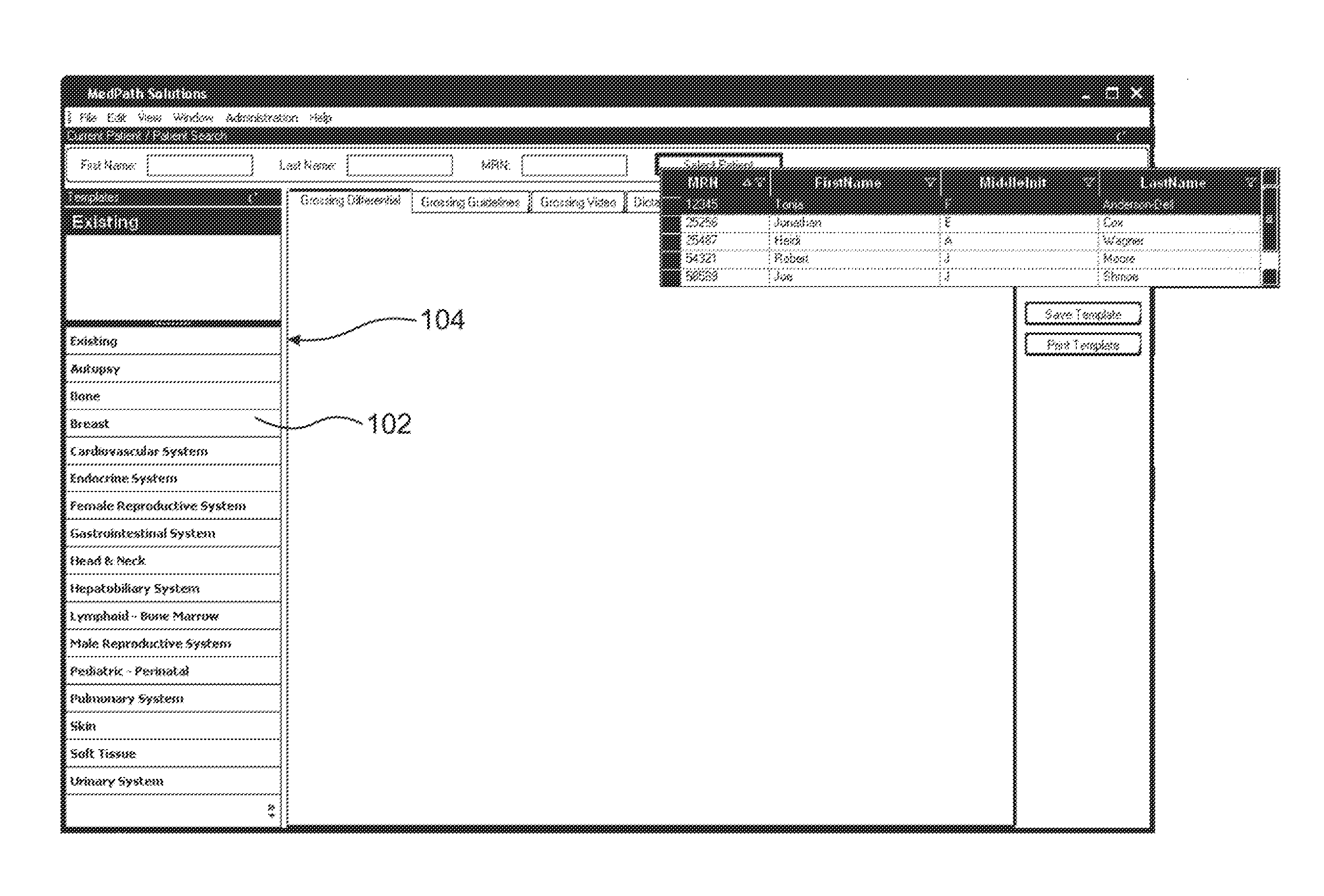 Computer based standardized method and apparatus for guiding decision support for surgical anatomic pathology operations